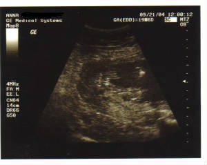 ultrasound4.jpg