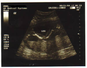 ultrasound8.jpg
