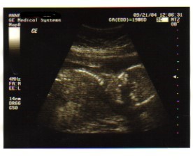 ultrasound7.jpg